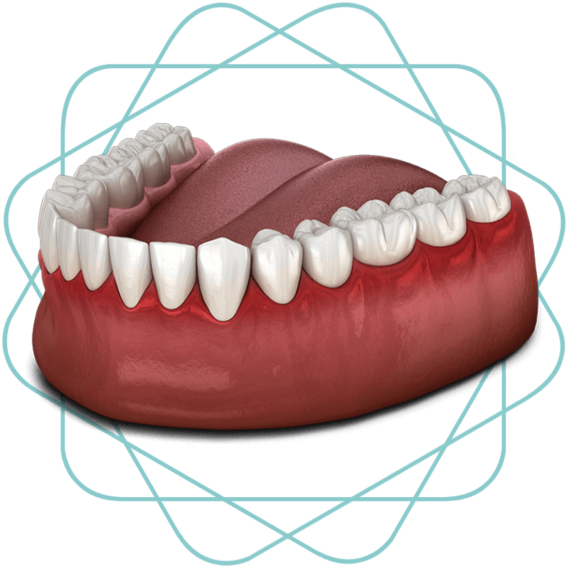 gum disease issue1